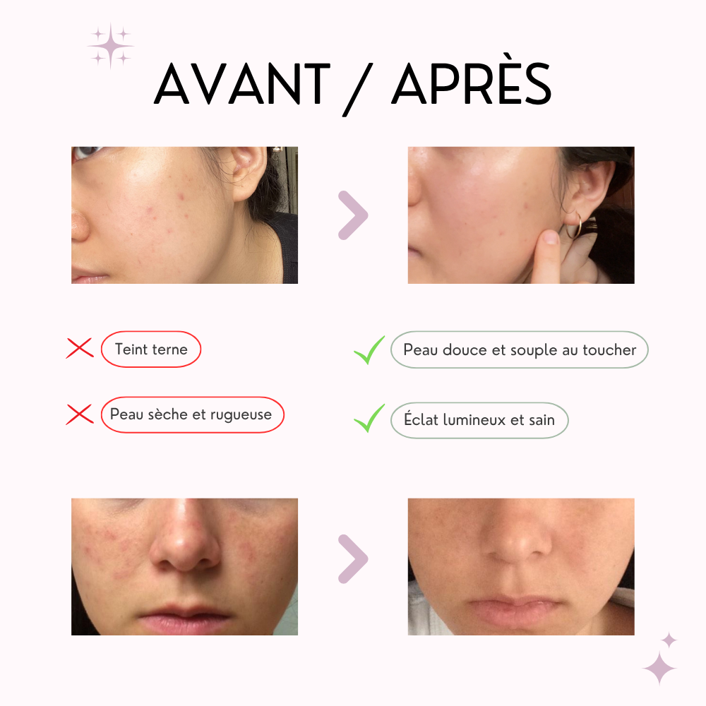 abib masque tissu ph doux au miel – nutrition & Éclat abib masque tissu ph doux au miel – nutrition & Éclat