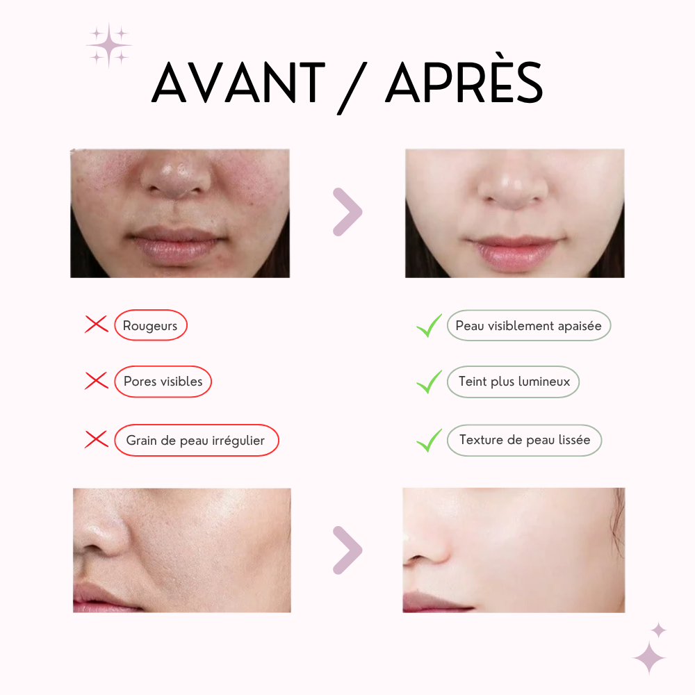 anua masque Éclat à la pêche 70% & niacinamide anua masque Éclat à la pêche 70% & niacinamide