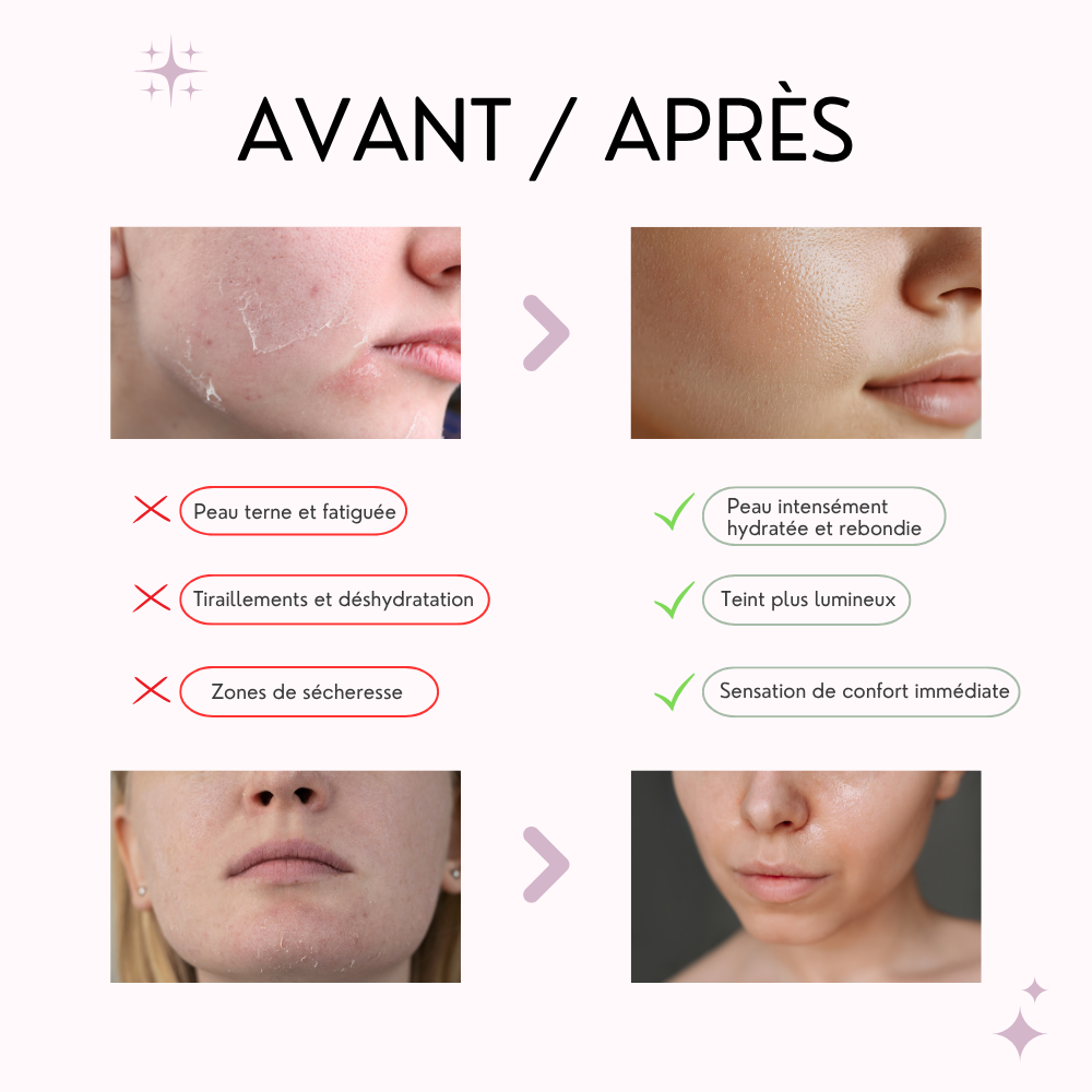 anua masque sérum pdrn & acide hyaluronique anua masque sérum pdrn & acide hyaluronique