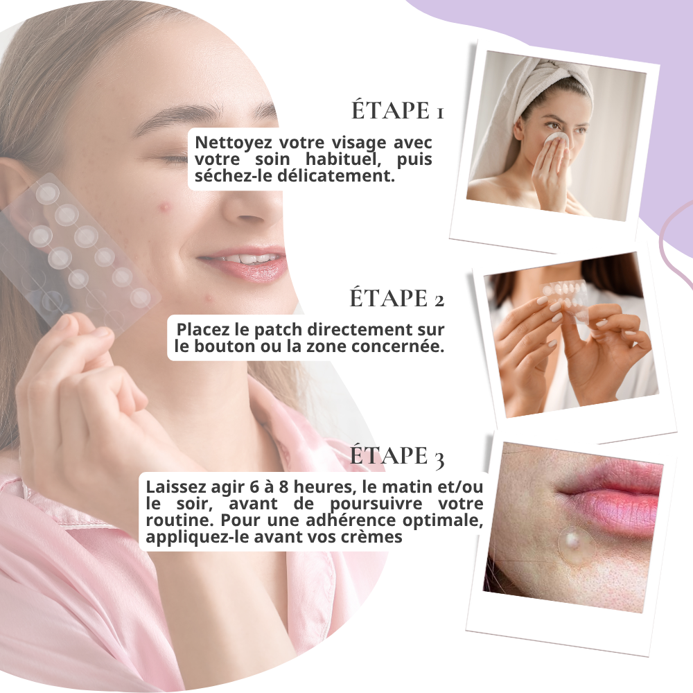 some by mi patch boutons, anti imperfections – 18 patchs some by mi patch boutons, anti imperfections – 18 patchs