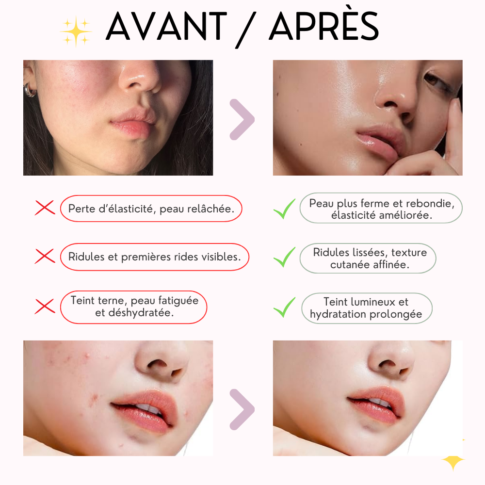 medicube masque gel collagène rose au pdrn medicube masque gel collagène rose au pdrn