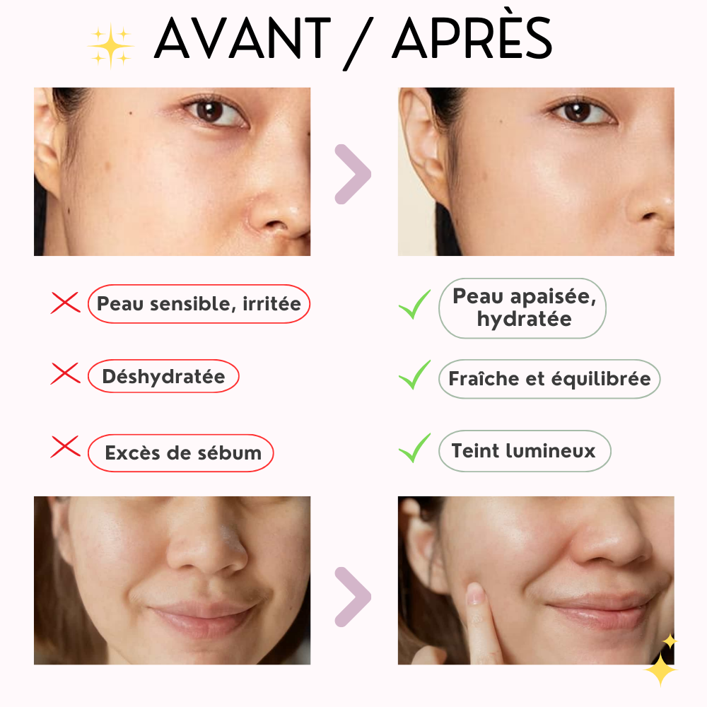 skin1004 – masque tissu gel à l’ampoule de centella de madagascar skin1004 – masque tissu gel à l’ampoule de centella de madagascar