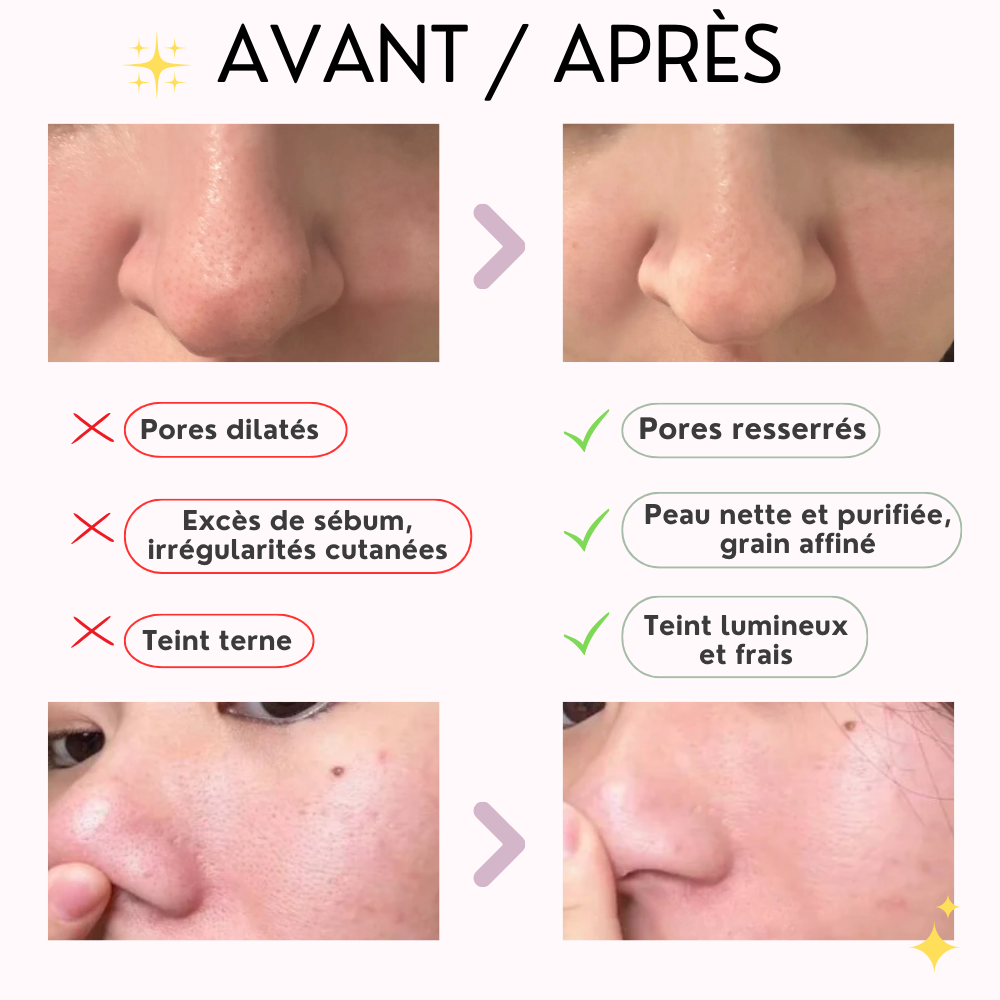 skin1004 – stick masque argile centella de madagascar poremizing skin1004 – stick masque argile centella de madagascar poremizing